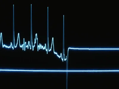 mateusza - > leżysz w szpitalu podłączony do aparatury monitorującej bicie serca
 pik...