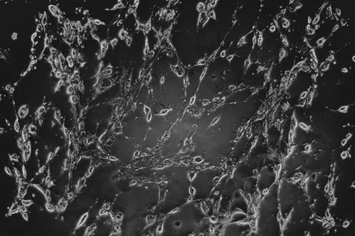 kundziukundziu - Ludzka linia komórkowa - glejak wielopostaciowy. Zdjęcie własne.
#f...
