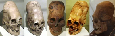 l.....s - Niewymiarowa czaszka podobna do tych znalezionych w Paracas. Jest w nich co...