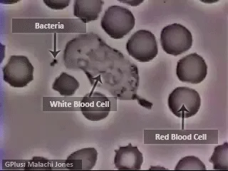 Deykun - Biała krwinka dopada bakterie.



#gif #krwinka #biologia #napewnoniebylo