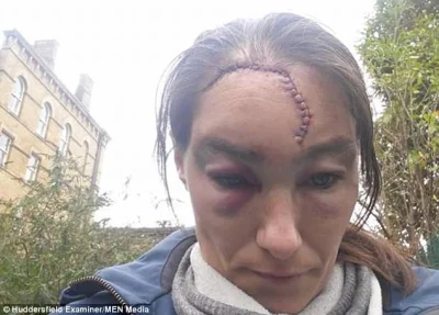 PozytywistycznaMetamorfoza - > Nikki Hurst, 32, was assaulted by three Asian men as s...