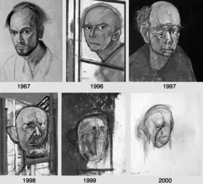 debustrol - Autoportret artysty cierpiącego na chorobę Alzheimera. Niestety nie wiem,...