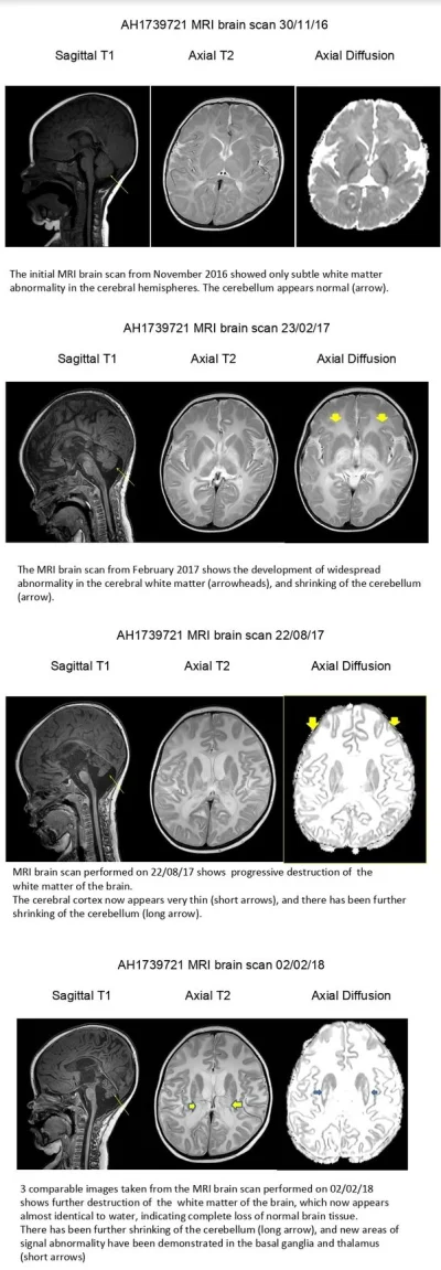 TJ_Laser - Udało mi się znaleźć w internecie opublikowane w lutym skany MRI mózgu teg...