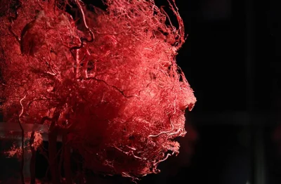 macandy - Sieć naczyń krwionośnych w ludzkiej twarzy.



#ciekawostki #obrazek #biolo...