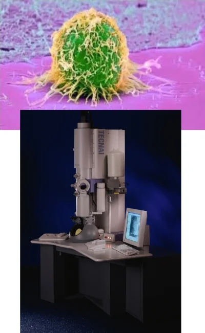 h.....l - A tu widzimy rzadki przykład mikroskopu elektronowego pod komórką rakową ( ...