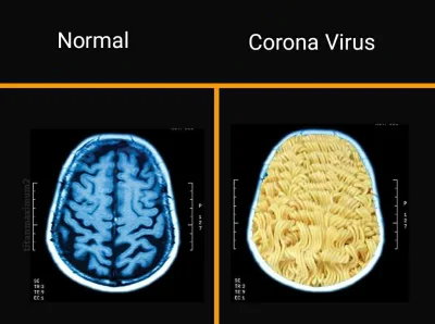 klossser - Zdjęcie mózgu osoby zarażonej chińskim wirusem 

#chiny