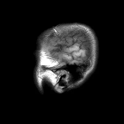 bauagan - #gif #mri #ciekawostki