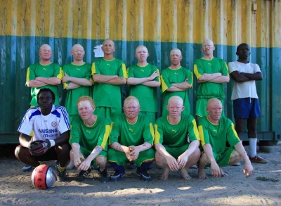 quiksilver - Albino United -Tanzania 

#pilkanozna #afryka #albinosi