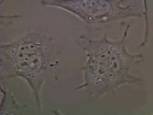 tojuzprzesada - Kiedy komórki przestają być potrzebne, popełniają "programowane samob...