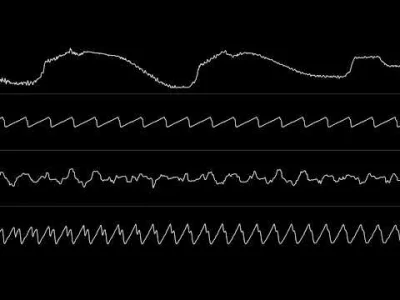 xandra - Jogeir Liljedahl: “Nearly There” i “Nes-Tea” (｡◕‿‿◕｡) 

#muzyka #commodore...