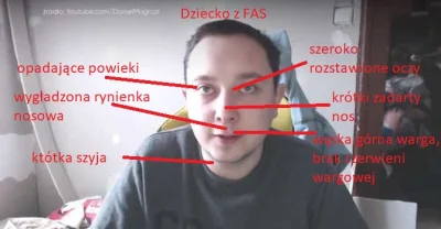 mariusz0 - Dzisiaj światowy dzień FAS, Alkoholowego Zespołu Płodowego. Z tej okazji w...