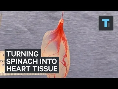 Siaa - @mp3-10: można wyhodować na szpinaku np. komórki serca czy inne tkanki. Roślin...