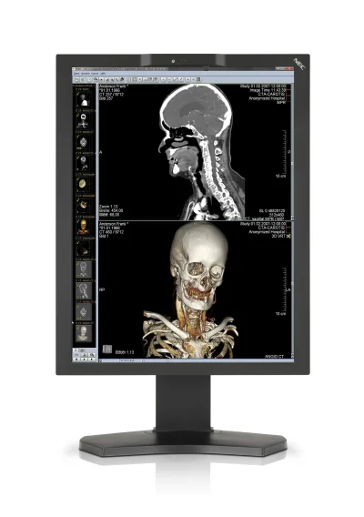youpc - #nec #display #solutions wprowadza nowy #medyczny #monitor #diagnostyczny MD2...