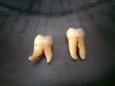 Rampampam - #dentysta #ósemki #chwalesie

No elo. Po lewej górna, po prawej dolna
...