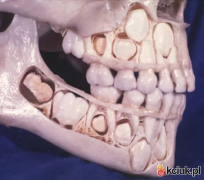 kemot88 - Czaszka dziecka z widocznymi zawiązkami zębów stałych. 

#medycyna #denty...
