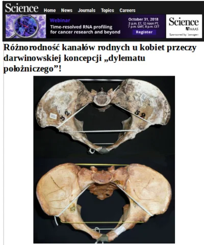 bioslawek - Różnorodność kanałów rodnych u kobiet przeczy darwinowskiej koncepcji „dy...