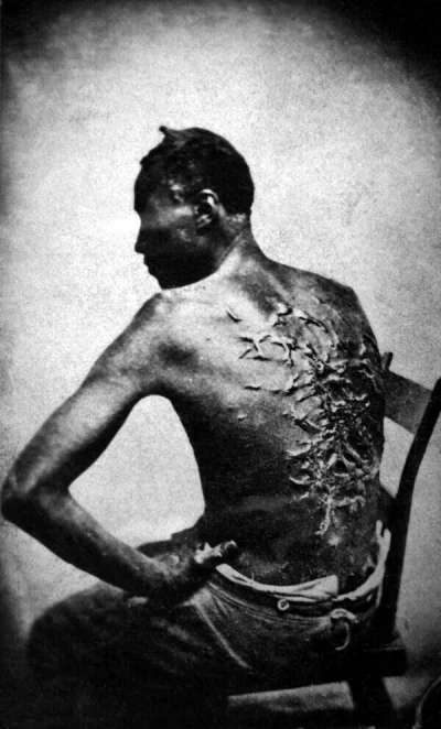 HaHard - Były niewolnik Gordon pokazuje blizny po biczowaniu.
Baton Rouge, Louisiana...