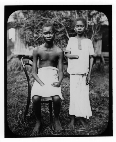 Sankullo - Kongo belgijskie rok 1908. Dzieci ukarane za zbyt powolne zbieranie kauczu...
