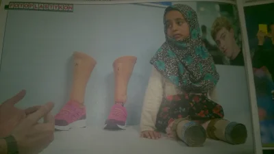 elady1989 - #syria #swiat #wojna protezy dla ośmioletniej syryjki wcześniej nosila pu...