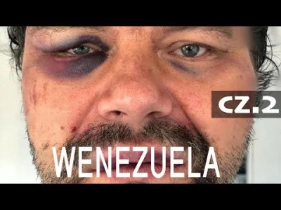 CHI77OUT - Wywiad z Polakiem pobitym w Wenezueli - część druga..

#bezplanu #ciekawos...