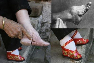 RobieInteres - Kiedyś w Chinach krępowano stopy, żeby było "piękniejsze". Później teg...