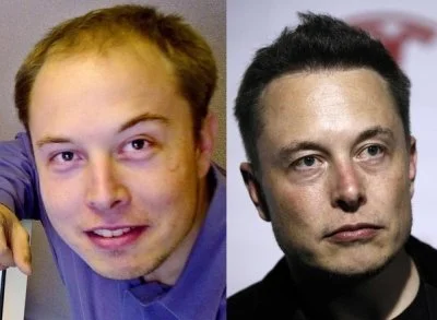 MikiMarcin - Nie ma ludzi brzydkich, są tylko ludzie biedni. Elon Musk miał zakola al...