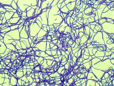 klebsiella - Ciekawostka przyrodnicza: tak wyglądają komórki bakteryjne E.coli, które...