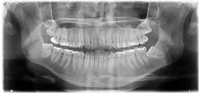 Ekstravaganza - Kto ostatnio odwiedził po pół roku odkładania kasy ortodontę w celu n...