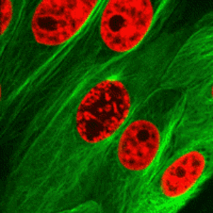 Mishkaliina - Mitoza, czyli podział komórki, widoczna pod mikroskopem fluorescencyjny...