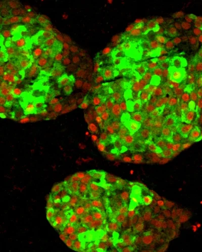 sznaps82 - Na zdjęciu klastry trzustkowych komórek beta pochodzące z ludzkich pluripo...