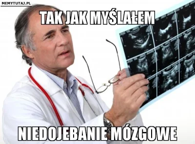 lsdyna - @headstrong: Innej diagnozy nie idzie w tym przypadku postawić pisokomuszku.