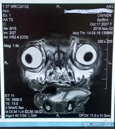 anoysath - Zdjęcie przedniej części głowy mopsa wykonane za pomocą skanera rezonansu ...