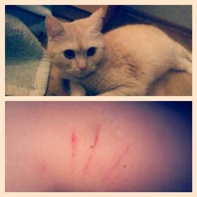 zloty_wkret - zawsze jak mnie podrapie kot, to dumnie demonstruję moje rany tak, jakb...