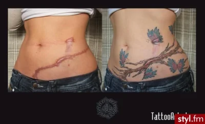 czworokot - Tatuażem można zasłonić bliznę