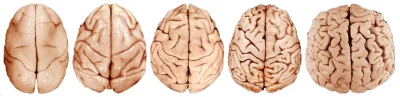 PajonkPafnucy - @farmerjanek: Ich mózgi kształtują się bardzo powoli.
Od lewej do pr...