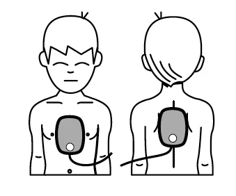u.....a - #medycznewow Ciekawostka 12

Przy użyciu AED u dzieci w wieku 1-8, jedną ...