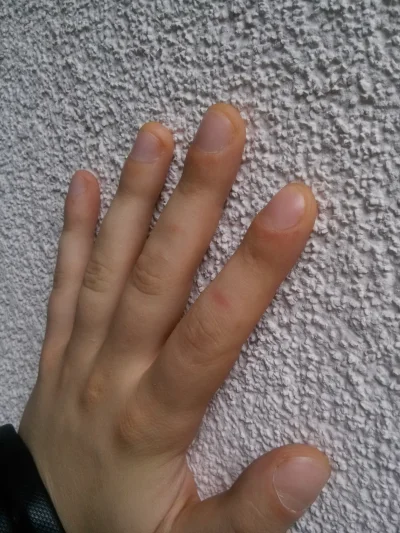Michal_LBN - Czy moje palce są normalne? Paznokcie są zaokrąglone ale raczej delikatn...