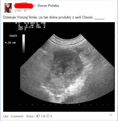 erbeka - #kinderniespodzianka #heheszki #durex #facebookcontent

( ͡° ͜ʖ ͡°)