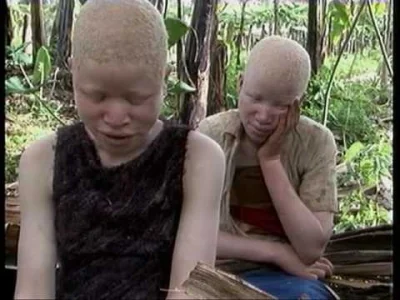 Zadruga - @gkm: 

występują albinosy ale szybko są zjadani przez kolegów