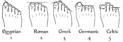 laleczkaZsaskiej - a Wy mirki i mirabelki? jaki macie kształt stopy?

#glupiewykopo...