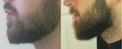 maze - Mały update brody. Mój przyjaciel ma 3.5 miesiąca. Niestety nie miałem czasu o...