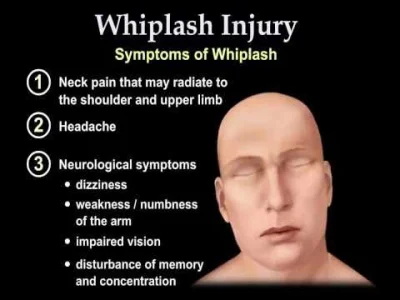 megawatt - @Ranger: tak
https://en.wikipedia.org/wiki/Whiplash_(medicine)