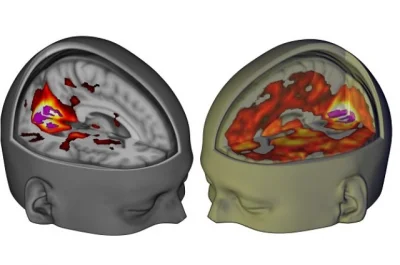 kahor - wizualizacja tego, co dzieje się w mózgu na #lsd
#ciekawostki #narkotyki #ps...