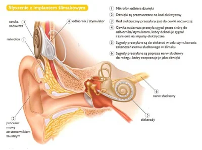 Kraudia - @Melodykop nie każdy może korzystać z aparatu słuchowego, ponieważ on jedyn...