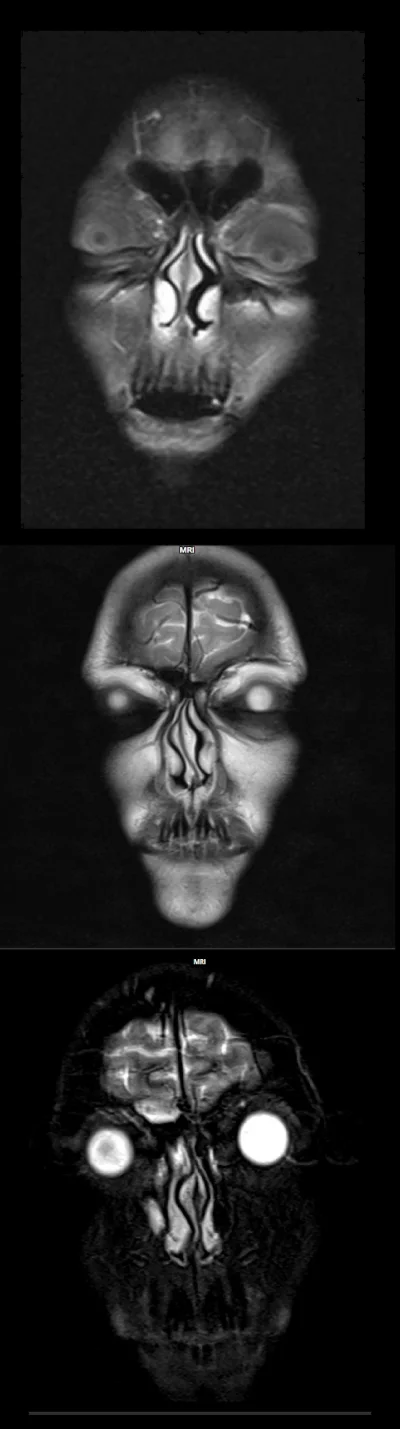 Eustachiusz - Widzieliście kiedyś ludzką głowę w tomografii albo rezonansie w przekro...