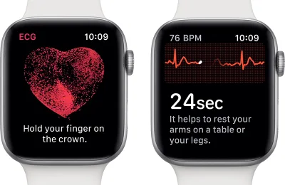 Ripper - ECG dostępne w #applewatch w watchOS 5.2 ᶘᵒᴥᵒᶅ

#apple #ios