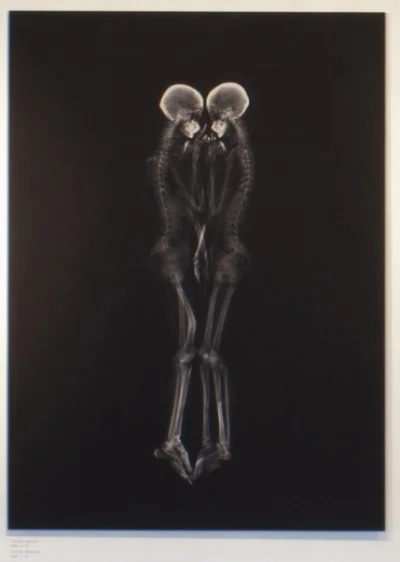 n.....o - Miłość na zdjęciach rentgenowskich. Więcej.

#sztuka #rentgen