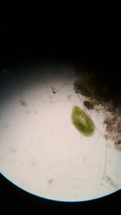 anonimowa - Dziś na zajęciach pod mikroskopem zobaczyłam zielonego ziomeczka :)
SPOI...