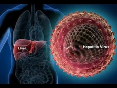 arslan-malik - szczepionki wirusowe zapalenie wątroby typu próby i aktualne leczenie ...