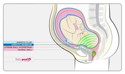 CoolHunters___PL - Testował ktoś? Babypod to dopochwowy głośnik dla nienarodzonych dz...